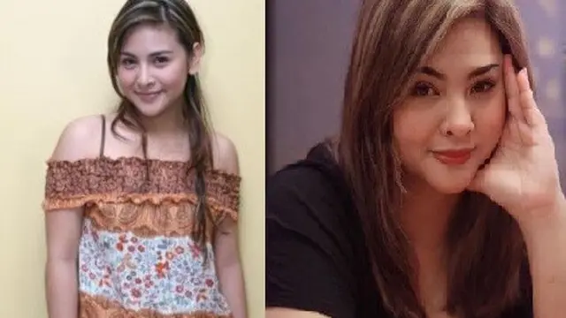 Audy Item (Istimewa)