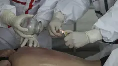 Seorang pasien yang terinfeksi virus corona COVID-19 menerima perawatan dengan teknik medis tradisional Tiongkok yang dikenal sebagai "bekam" di Rumah Sakit Palang Merah di Wuhan di provinsi Hubei China (11/3/2020). China melaporkan peningkatan kasus virus corona pada Maret 11. (AFP/STR)