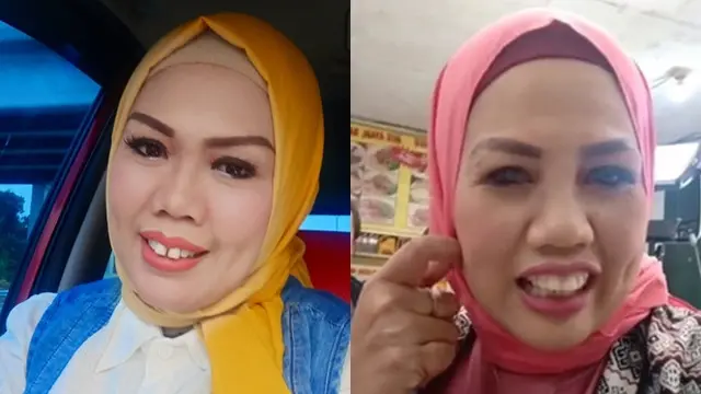 Beda Gaya Ely Sugigi Sebelum Vs Sesudah Potong Gigi (sumber: instagram/ellysugigi_real_)