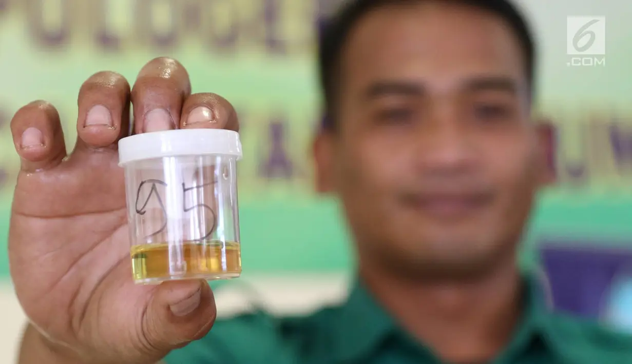 Sopir bus Antar Kota Antar Provinsi (AKAP) memperlihatkan sampel urine saat tes kesehatan di Terminal Pulo Gebang, Jakarta, Kamis (22/6). Tes urine untuk memastikan sopir dalam kondisi sehat dan tidak mengonsumsi narkoba (Liputan6.com/Immanuel Antonius)