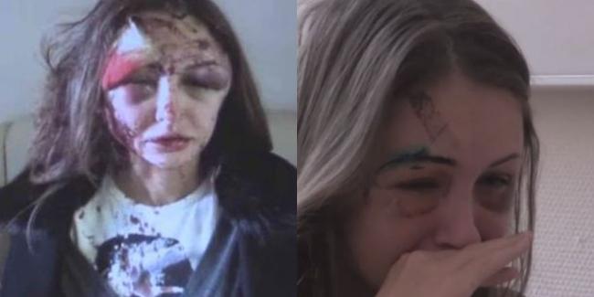 Foto: Copyright DailyMail.com | Alexandra setelah mengalami kekerasan fisik yang dilakukan kekasihnya