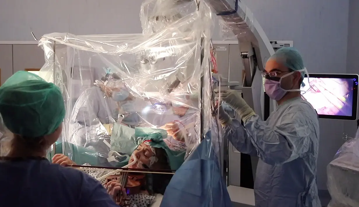 Gambar yang dirilis 19 Februari, musisi Dagmar Turner bermain biola saat berlangsungnya operasi pengangkatan tumor otak di King's College Hospital, London. Tim dokter berhasil mengangkat lebih dari 90 persen tumor dari perempuan 53 itu, termasuk yang paling agresif. (KING'S COLLEGE HOSPITAL/AFP)