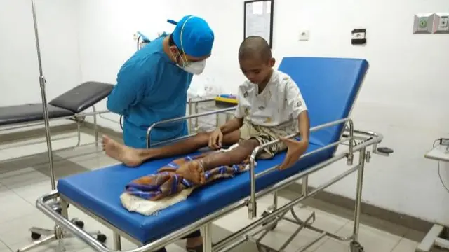 Kaki remaja di Natuna nyaris membusuk karena infeksi dan tak mampu berobat. (Foto: Batamnews.co.id)