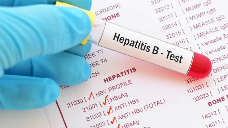 Tes Hepatitis B