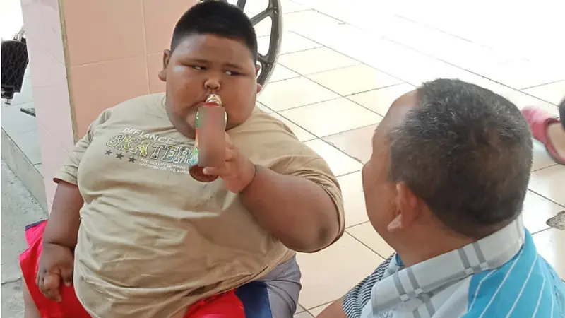 Bocah Obesitas Satia Jalani Observasi di RSUD Karawang