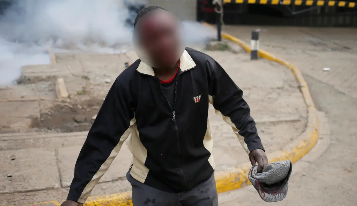 Seorang Demonstran terluka parah dibagian kepalanya usai dipukuli polisi saat bentrok di Nairobi, Kenya (16/5). Demonstran menuntut pembubaran otoritas pemilu karena adanya dugaan korupsi. (REUTERS/Goran (REUTERS/Goran Tomasevic)