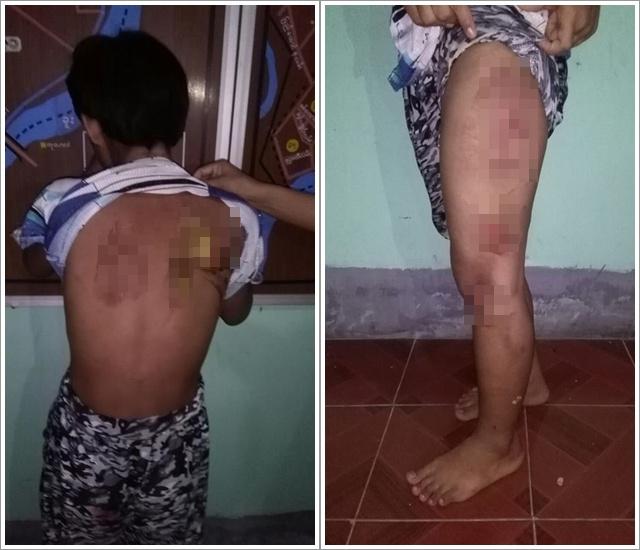 Tubuh anak yang disiksa majikannya dipenuhi luka | Copyright viral4real.com