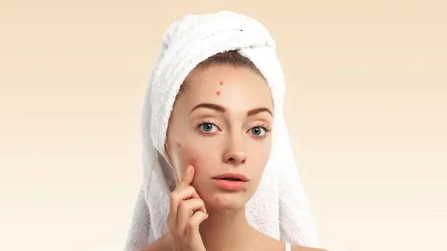 Ini Hal yang Bisa Menyumbat Pori-Pori Wajah dan Menyebabkan Jerawat (photo by freepik.com)