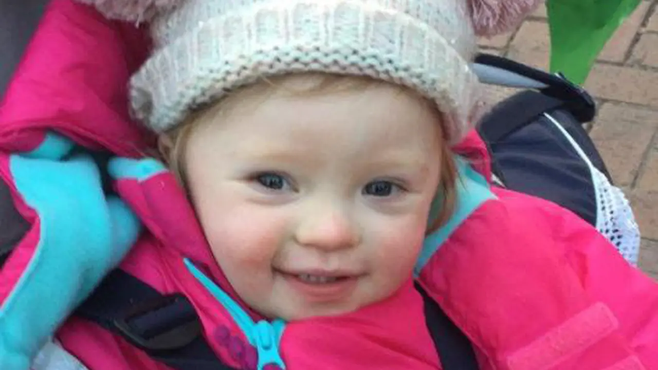 Model Down Syndrome