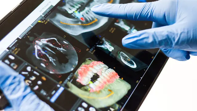 Tingkatkan Layanan Kesehatan, RS Pondok Indah Group Hadirkan Transformasi Digital