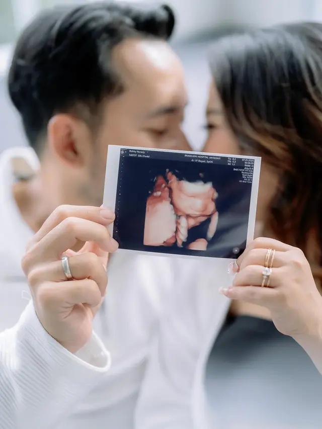 Kiky Saputri Maternity Shoot (instagram/kikysaputrii/windrafotografi).