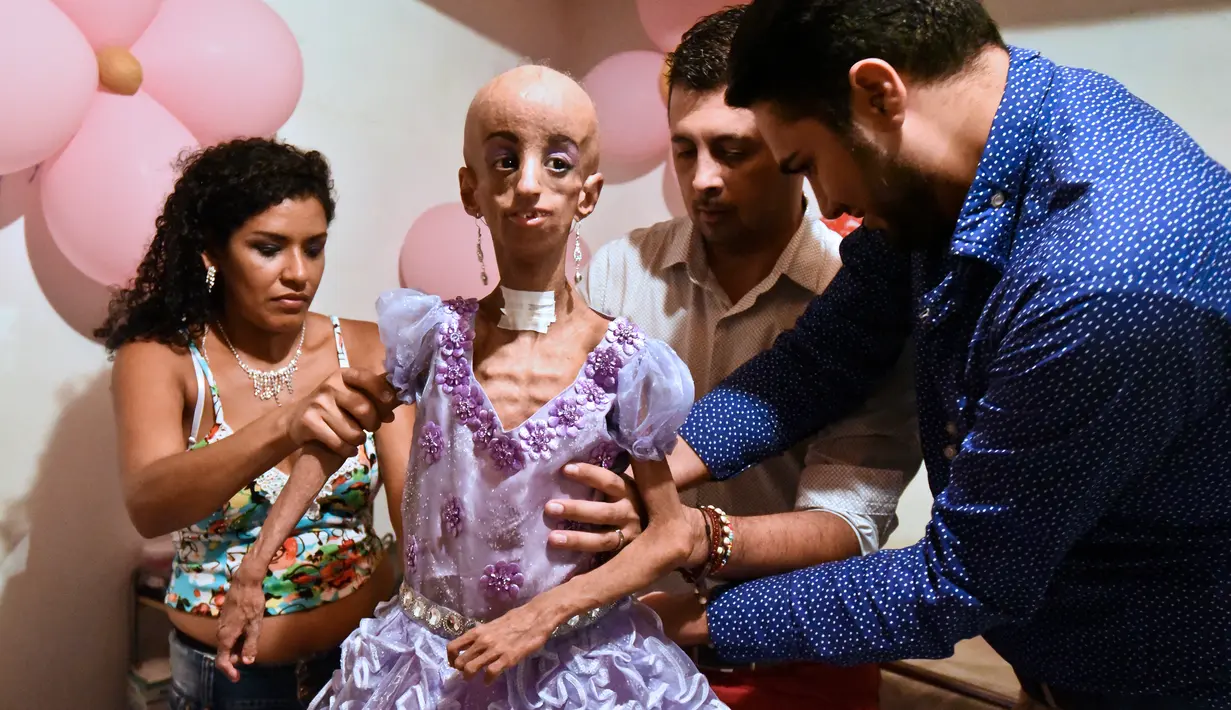 Magali Gonzalez Sierra didandani sebelum merayakan ulang tahun ke-15 di El Cabuyal, Kolombia, 16 Januari 2016. Magali menderita progeria, sebuah kelainan genetik yang membuat gadis kecil itu memiliki tubuh setara wanita berusia 90 tahun. (AFP/LUIS ROBAYO)