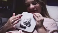 Ibu tunanetra ini menangis saat bisa 'melihat' bayi dalam kandungannya