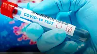 Hasil uji seka gubernur Abdul Gani Kasuba yang diterima 4 Juni 2020 dinyatakan terkonfirmasi negatif virus corona Covid-19.