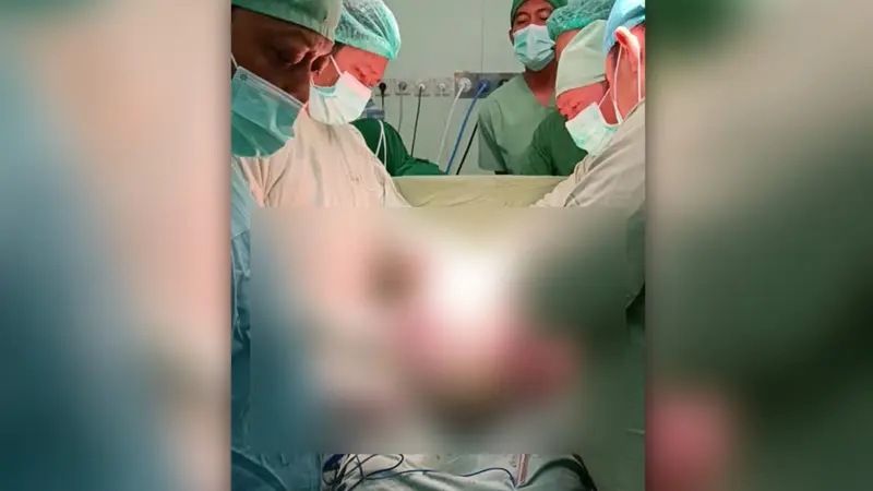 Seorang pasien tumor seberat 11 kilogram berhasil dioperasi di RSUD Dr R Soeprapto Cepu, Kabupaten Blora, Jawa Tengah. (Liputan6.com/Ahmad Adirin)
