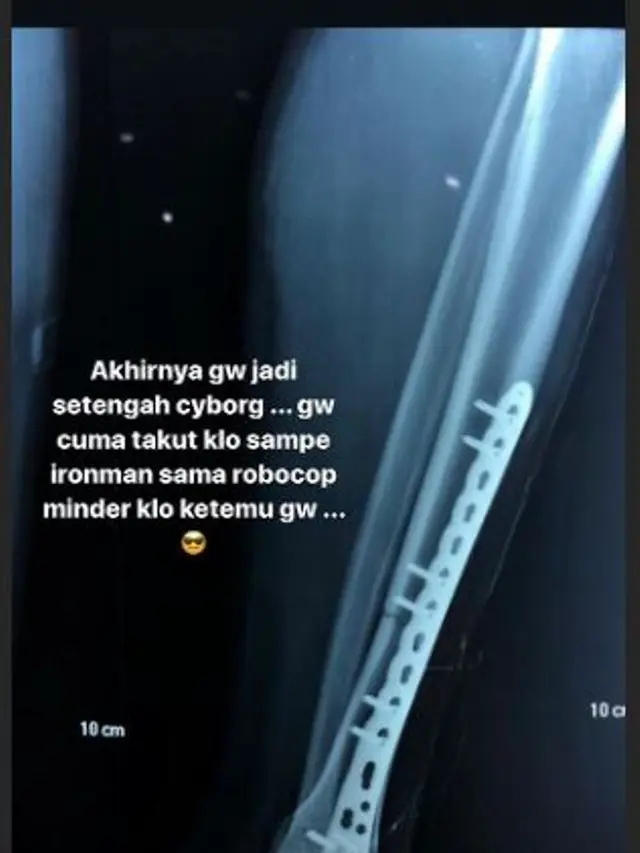Sammy Simorangkir (Foto: Instagram/@sammysimorangkir)