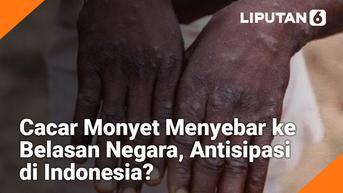 VIDEO: Cacar Monyet Menyebar Lebih dari 20 Negara, Antisipasi di Indonesia?