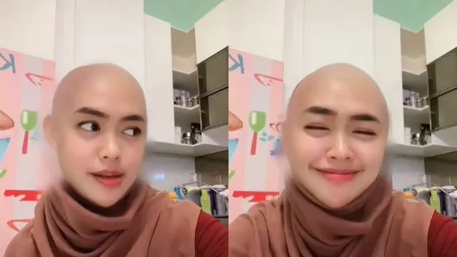 6 Potret Seleb Jajal Filter Botak Ini Kocak Banget
