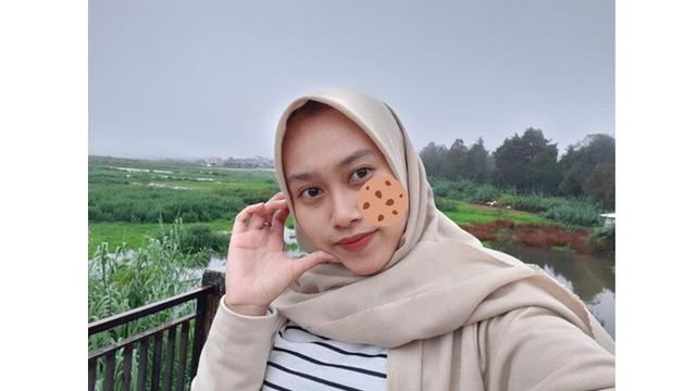 Wanita Ini Minta Jerawat Dihilangkan, 6 Hasil Editan Foto Bikin Senyum