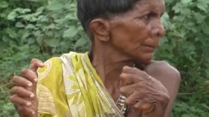 Kumar Nayak memiliki kondisi yang membuat jari tangan dan kakinya lebih banyak dari orang lain (Tangkapan Layar Video LAD Bible)