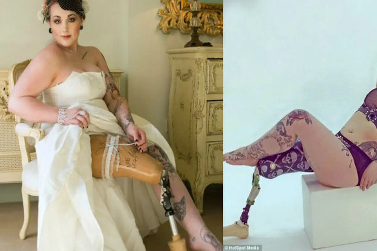 Kaki Diamputasi, Wanita Ini Justru Sukses Jadi Model