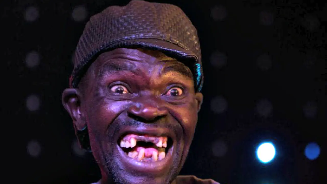 Juara Pertama 'Mr. Ugly' Diprotes Karena Kurang Jelek