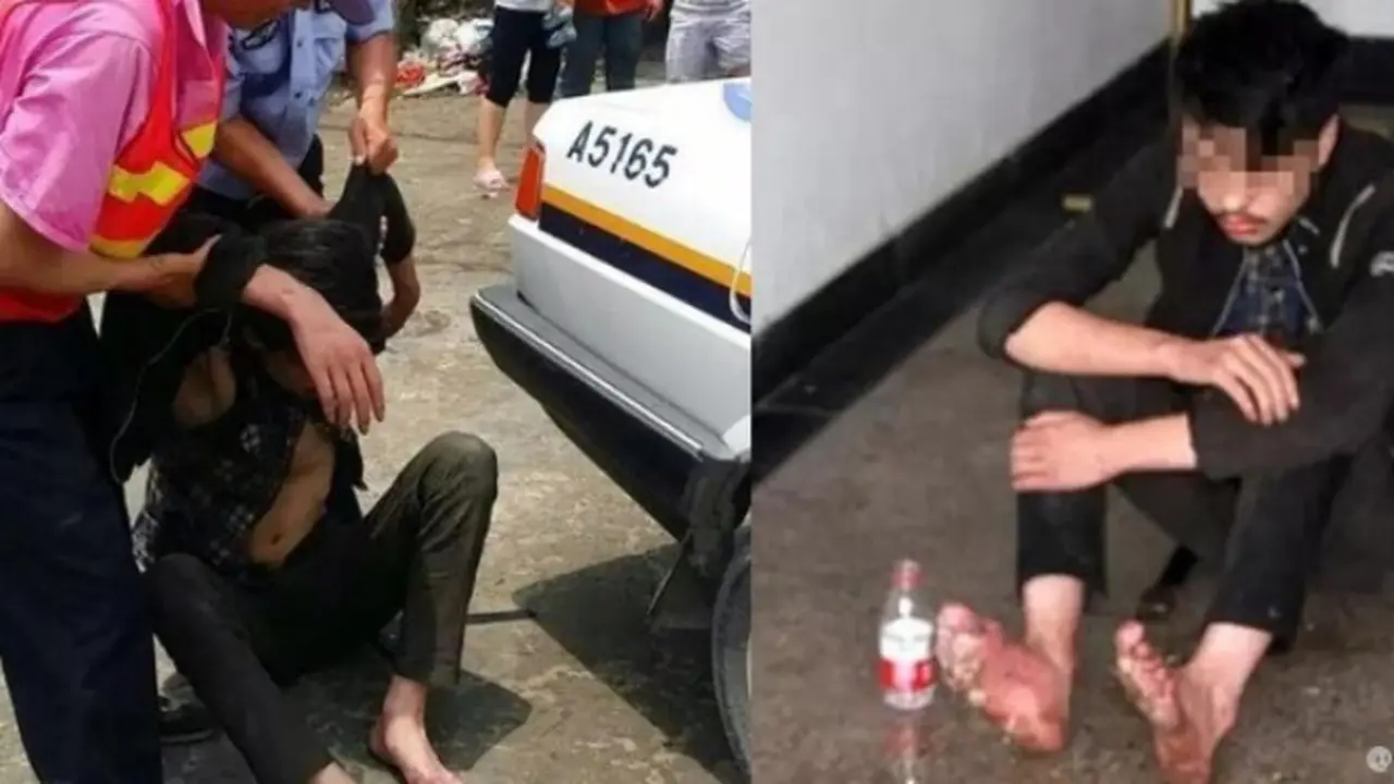 Kaki Pria Ini Membusuk Akibat Bermain Gim 6 Hari Non Stop