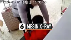 vertical xray