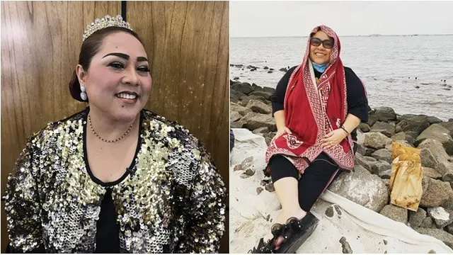 6 Beda Penampilan Artis Sebelum dan Sesudah Sakit Diabetes, Jadi Lebih Kurus