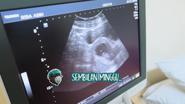 Hamil Anak Pertama, Ini 6 Momen Vebby Palwinta dan Razi Bagikan Kabar Bahagia
