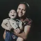 Tatiane do Nascimento menggendong putranya Willamis Silva, yang lahir dengan mikrosefali, salah satu dari banyak masalah medis serius yang dapat disebabkan oleh sindrom Zika bawaan. Willamis mengalami masalah menelan dan berat badannya tidak bertambah sehingga selang makanan dipasang. (Foto AP/Felipe Dana)