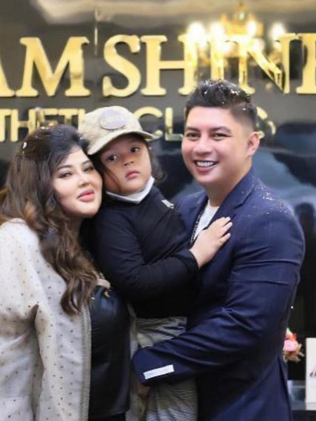 6 Potret Lawas Shindy Samuel, Sempat Kurus Sebelum Berat Badan Naik Drastis