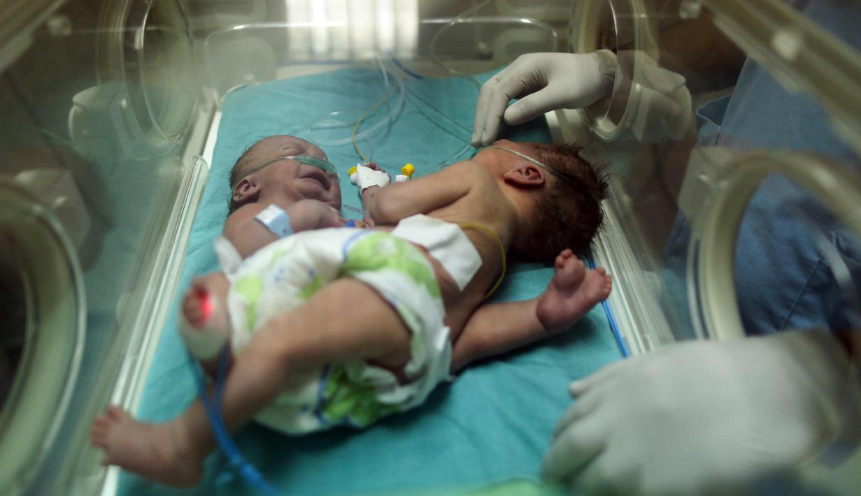 Bayi kembar siam berusia satu hari terlihat di dalam inkubator di Rumah Sakit al-Shifa di Kota Gaza, (22/10). Kepala rumah sakit al-Shifa mengatakan bayi ini akan dibawa ke luar negeri untuk dipisahkan. (AFP Photo/Mahmud Hams)