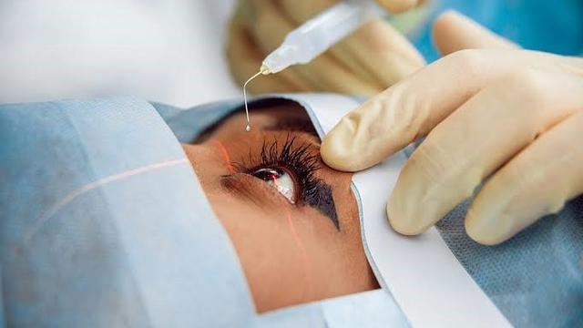 Ilustrasi operasi katarak (Istimewa)