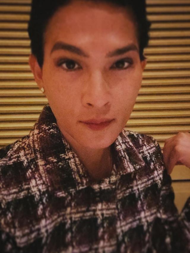 6 Potret Terbaru Oscar Lawalata Usai Operasi Ganti Kelamin, Curi Perhatian