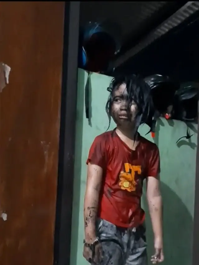 Tercebur ke got akibat dirundung teman