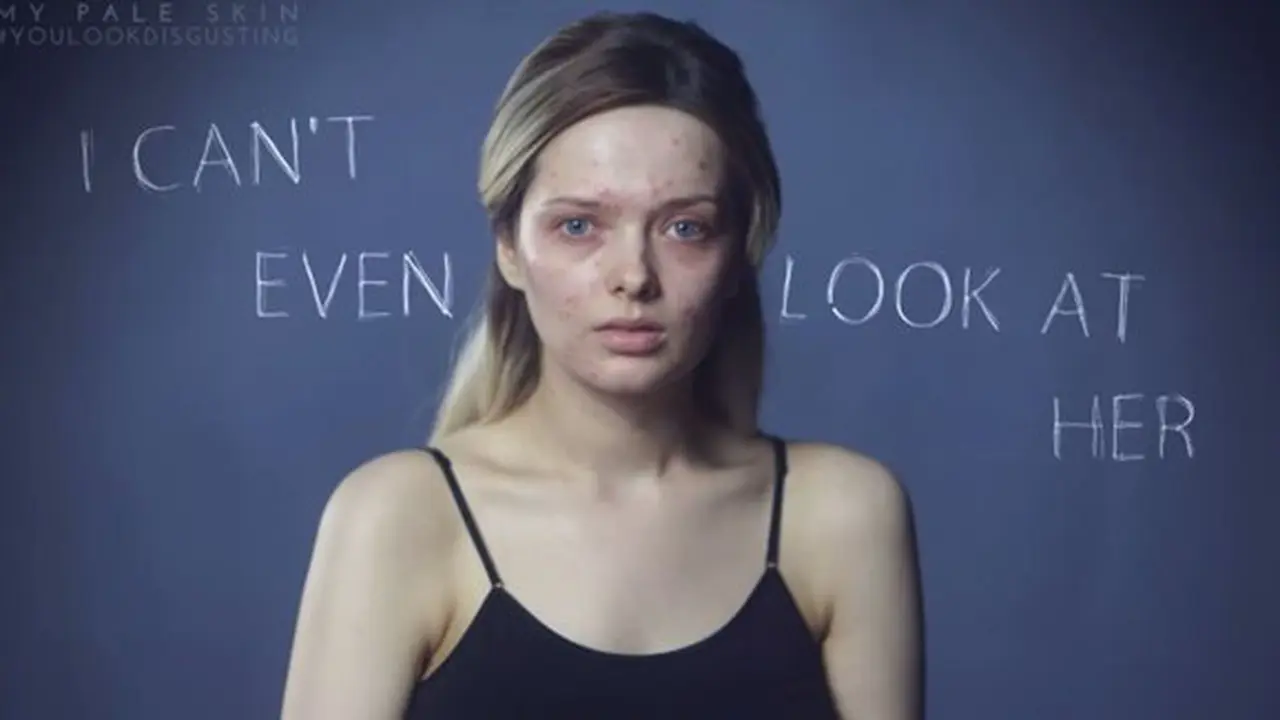 Foto: copyright Youtube.com/My Pale Skin
