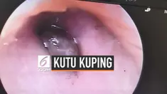 Seorang wanita mengeluh ada sesuatu di dalam kupingnya. Setelah diperiksa ternyata ditemukan kutu penghisap darah yang ada di saluran telinga.