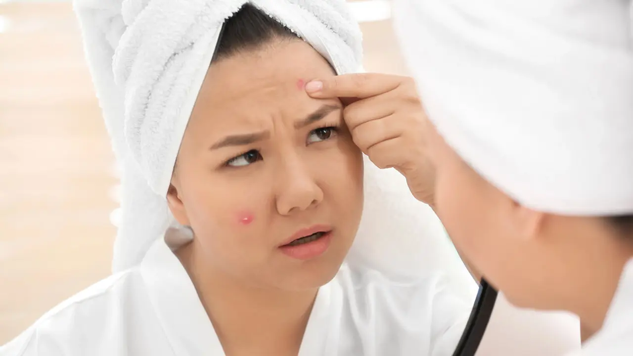 Perawatan Wajah Akurat untuk Atasi Bekas Jerawat, Acne Fighter Wajib Merapat!