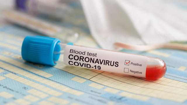 Salah Satu Dokter Rumah Sakit di Ternate Tertular Virus Corona
