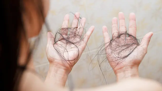 Ciri-ciri Rambut Rontok Berlebihan yang Wajib Diwaspadai, Segera Temukan Perawatan yang Tepat!