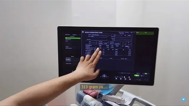 6 Momen Cut Meyriska Periksa Kandungan, Wajah Bayinya Curi Perhatian