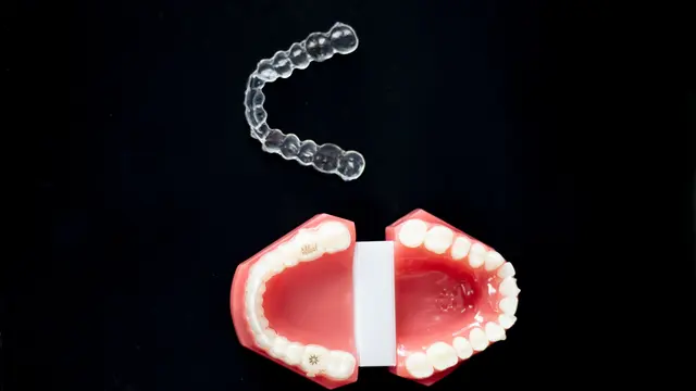 Pelindung Gigi atau Mouthguard