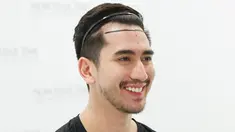 Melalui akun Instagram, Verrell Bramasta membagikan momen saat dirinya memutuskan untuk menjalani transplantasi rambut. Ia juga mengungkapkan jika garis rambutnya mulai mundur dan tak merata sejak 2020 lalu. (Liputan6.com/IG/@bramastavrl)