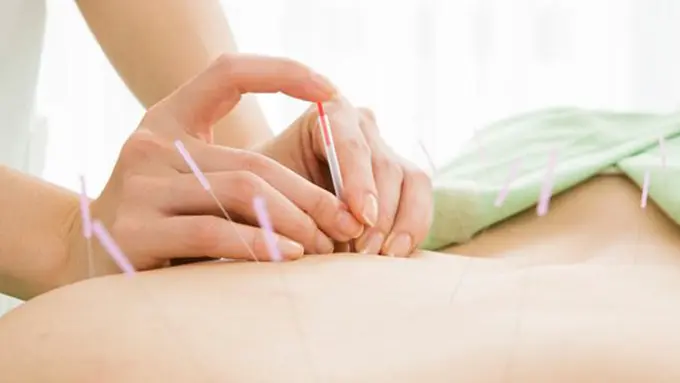 Akupuntur bantu melawan kanker payudara/copyright holisticdrugrehab.com