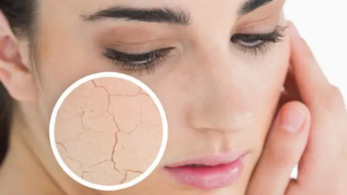 5 Cara Mengejutkan untuk Memerangi Kulit Kering