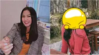Akui Jalani Operasi Rhinoplasty, Ini 6 Potret Terbaru Dara Arafah