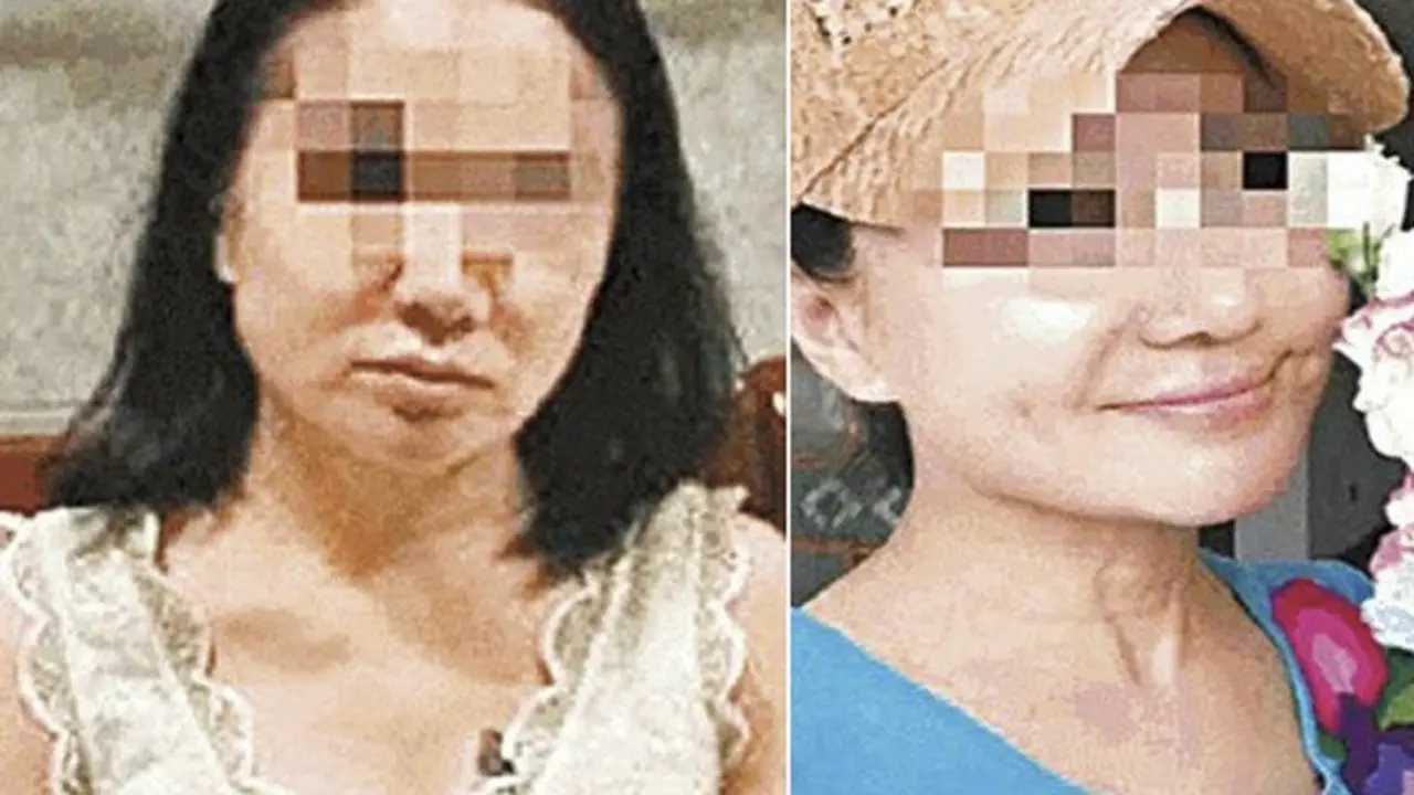 Hindari Utang Rp 63 Miliar, Wanita 60 tahun Nekat Operasi Plastik