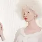 Thando Hopa, Model Albino Mendunia karena Banyak Prestasi