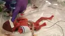 Foto pada Desember 2018, seorang bayi yang dipanggil dengan nama Saybie. Diyakini sebagai bayi terkecil yang pernah selamat dari kelahiran prematur, berat badan Saybie sama dengan sebuah apel besar ketika ia dilahirkan pada usia 23 minggu dan tiga hari Desember 2018 lalu. (HO/AFP/SHARP HEALTHCARE)